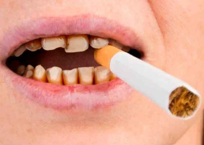 1 ¿Cómo afecta el cigarro a la salud de los dientes?