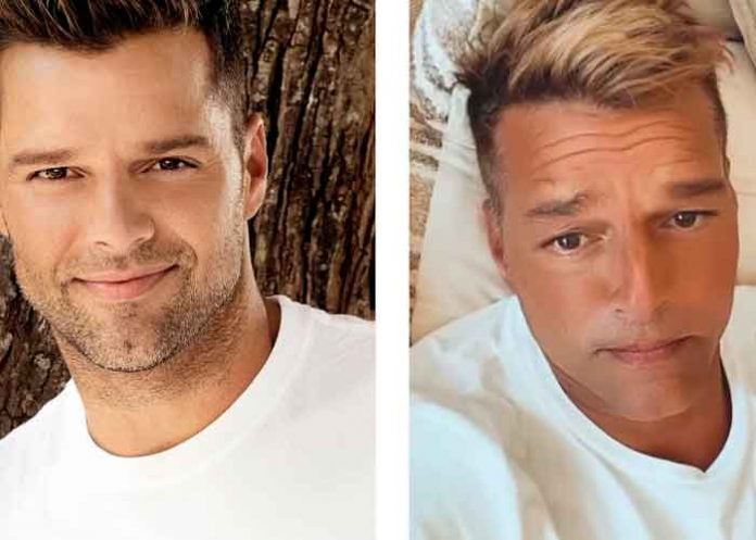 VIDEO: Ricky Martin rompió el silencio tras controversia por cambios en su rostro