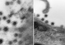Así se ve la variante Delta del coronavirus a través de un microscopio Así se ve la variante Delta del coronavirus a través de un microscopio
