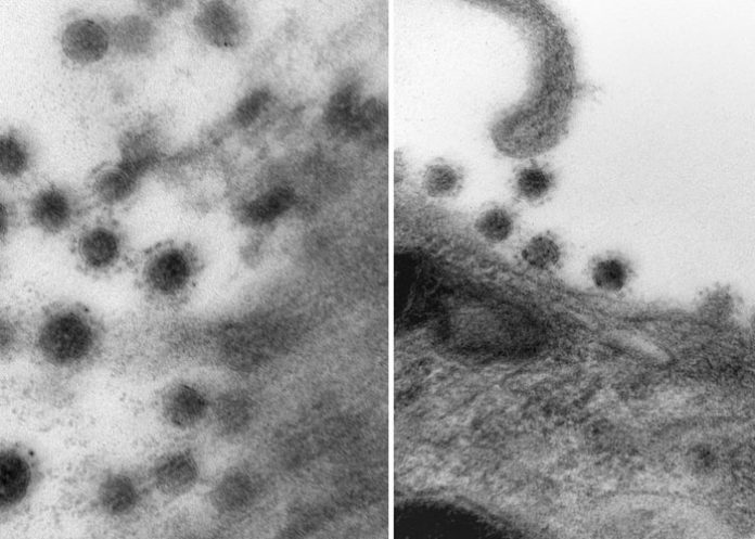 Así se ve la variante Delta del coronavirus a través de un microscopio