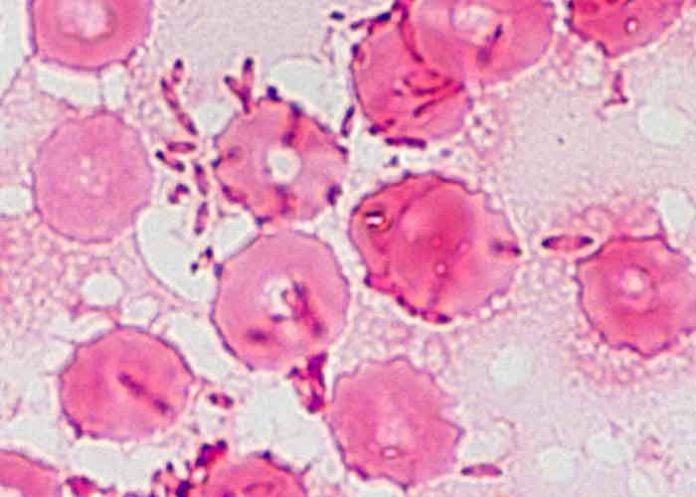 Una mujer en EE.UU contrae una rara enfermedad por su acuario