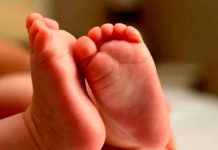Despiden a enfermera por publicar foto de un bebé con los «intestinos fuera» Despiden a enfermera por publicar foto de un bebé con los "intestinos fuera"