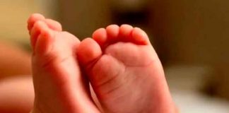 Despiden a enfermera por publicar foto de un bebé con los "intestinos fuera"