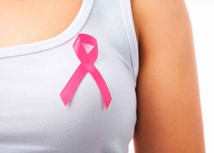 Cáncer de mama, principal causa de muerte en mujeres en Costa Rica