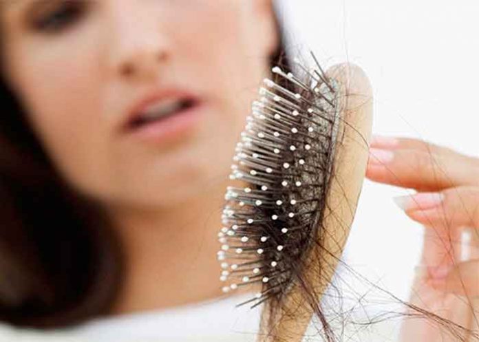 Caída de pelo por estrés, estos son los 3 tipos de pérdida asociados