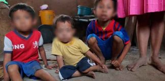 39 niños en Guatemala murieron de desnutrición aguda durante el 2021