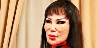 ¿Otra cirugía? Lyn May sorprende al aparecer con un rostro rejuvenecido