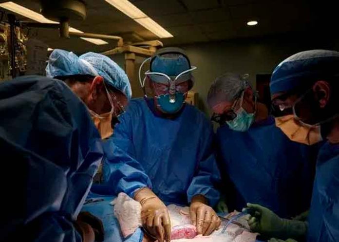 ¡Un éxito! Logran trasplantar un riñón de cerdo a un humano por primera vez