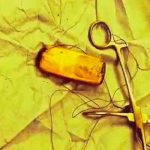 Se quejaba de dolor estomacal y descubrieron un teléfono en su intestino Se quejaba de dolor estomacal y descubrieron un teléfono en su intestino
