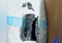 Viral: Se lo agrandó y lo metió en un tubo PVC para "medir su virilidad"