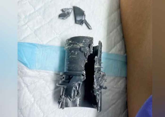 Viral: Se lo agrandó y lo metió en un tubo PVC para 