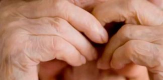 Dos menores humillan, rapan y quema el pelo de una mujer discapacitada