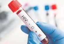 OMS se muestra preocupada por aumento de infecciones de VIH en Europa