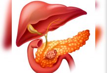 18 de noviembre: Día Mundial del Cáncer de Páncreas
