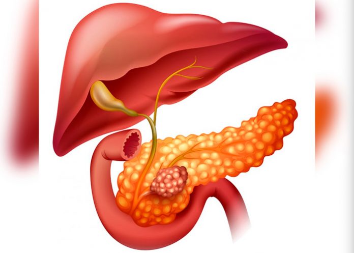 18 de noviembre: Día Mundial del Cáncer de Páncreas