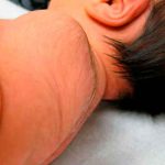 ¡Clase cola! Niño de Brasil es caso de estudio por su extraña condición ¡Clase cola! Niño de Brasil es caso de estudio por su extraña condición