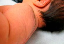 ¡Clase cola! Niño de Brasil es caso de estudio por su extraña condición ¡Clase cola! Niño de Brasil es caso de estudio por su extraña condición