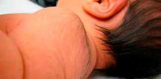 ¡Clase cola! Niño de Brasil es caso de estudio por su extraña condición