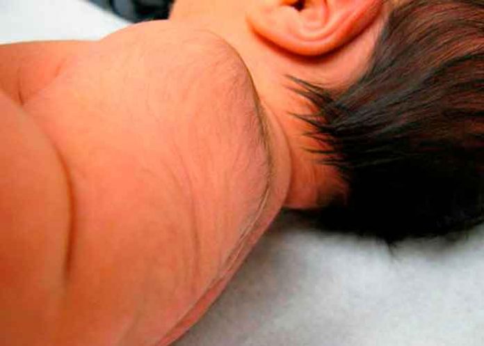 ¡Clase cola! Niño de Brasil es caso de estudio por su extraña condición