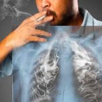 El humo de leña causa el 35 % de los casos de cáncer de pulmón en México