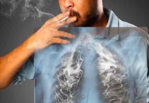 El humo de leña causa el 35 % de los casos de cáncer de pulmón en México