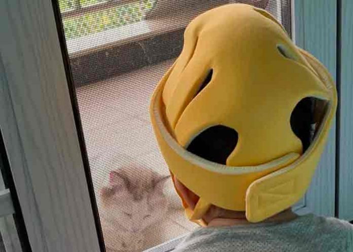 China: Padres ponen cascos a sus bebés para moldearles la cabeza