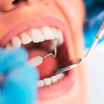 Estas señalas te manda tu boca para saber si sufres diabetes Estas señalas te manda tu boca para saber si sufres diabetes