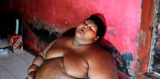 ¡Si se puedo! El niño más gordo del mundo logro bajar de peso,