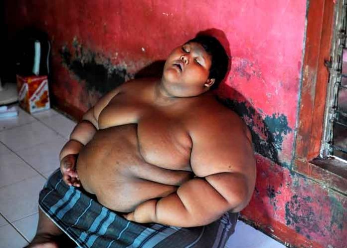 ¡Si se puedo! El niño más gordo del mundo logro bajar de peso,