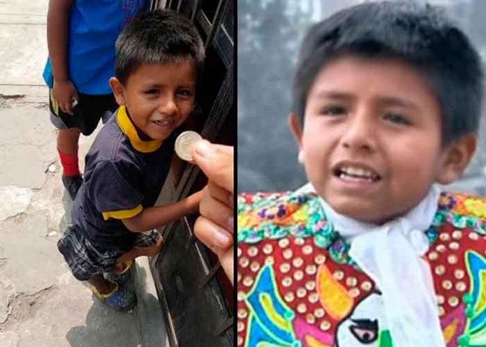 La historia de Tilín, el niño que se robó el corazón del mundo