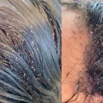 ¿Tenes piojos y te da pena rascarte en público?, aquí te dejamos cómo combatirlos Tenes piojos y te da pena rascarte en público, aquí te dejamos cómo combatirlos.