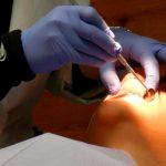 Descubren en un paciente que se quejó de problemas respiratorios un diente en su nariz Descubren en un paciente que se queja de problemas respiratorios un diente en su nariz