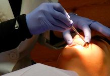 Descubren en un paciente que se quejó de problemas respiratorios un diente en su nariz Descubren en un paciente que se queja de problemas respiratorios un diente en su nariz