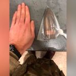 ¡Uy! Le sale el tiro por la culata: Extraen bala enterrada en el trasero ¡Uy! Le sale el tiro por la culata: Extraen bala enterrada en el trasero