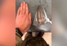 ¡Uy! Le sale el tiro por la culata: Extraen bala enterrada en el trasero ¡Uy! Le sale el tiro por la culata: Extraen bala enterrada en el trasero