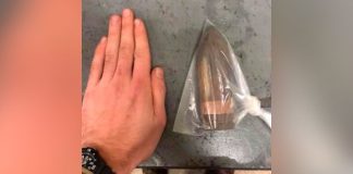 ¡Uy! Le sale el tiro por la culata: Extraen bala enterrada en el trasero