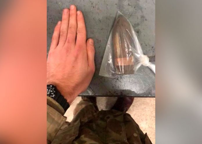 bala2 ¡Uy! Le sale el tiro por la culata: Extraen bala enterrada en el trasero