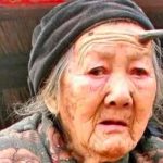 Zhang Ruifang se vuelve viral por su cuerno de seis centímetros en la frente