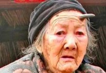 Zhang Ruifang se vuelve viral por su cuerno de seis centímetros en la frente Zhang Ruifang se vuelve viral por su cuerno de seis centímetros en la frente