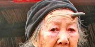 Zhang Ruifang se vuelve viral por su cuerno de seis centímetros en la frente