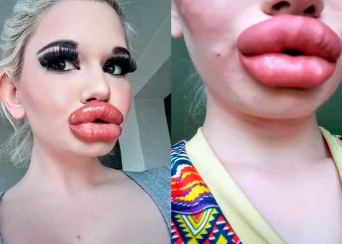 labios-mas-grandes-del-mundo Mujer con los labios más grandes del mundo quiere parecerse a una Bratz