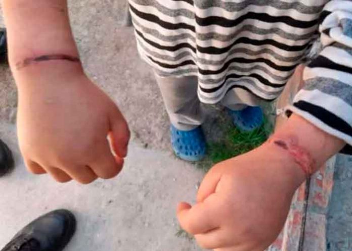 Rescatan a dos niños que eran atados y torturados por su madre en Argentina