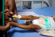 Guatemala: Aumentan a 51 las muertes infantiles por desnutrición 21 decesos infantiles en Guatemala