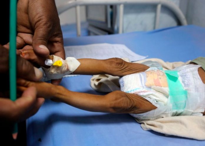 21 decesos infantiles en Guatemala