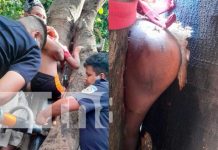 Bomberos rescatan a niño que quedó prensado entre dos árboles en Managua Managua: Bomberos rescatan a niño que quedó prensado entre dos árboles