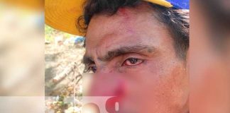 Amigos de tragos terminan peleando por rencillas personales en Nandaime