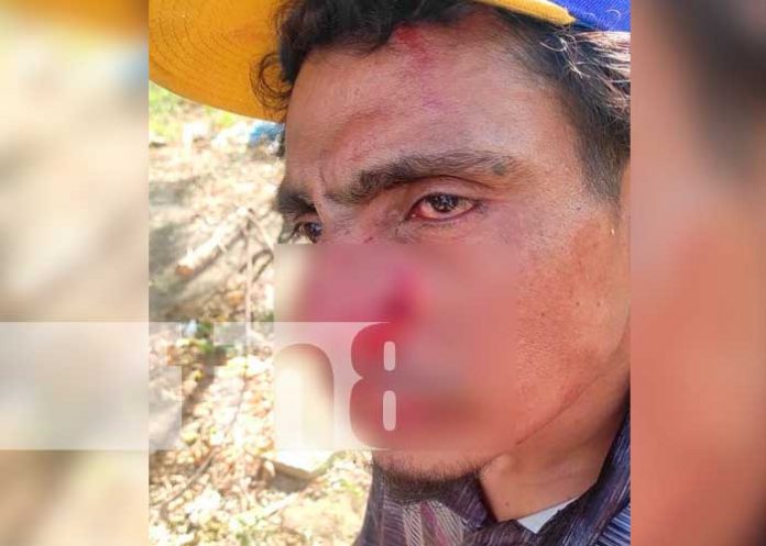 Amigos de tragos terminan peleando por rencillas personales en Nandaime