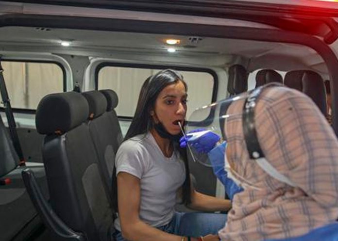 ¿Qué es flurona y cuáles son sus síntomas?