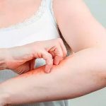 Descubren bacterias, hongos y virus desconocidos en la piel humana Descubren bacterias, hongos y virus desconocidos en la piel humana