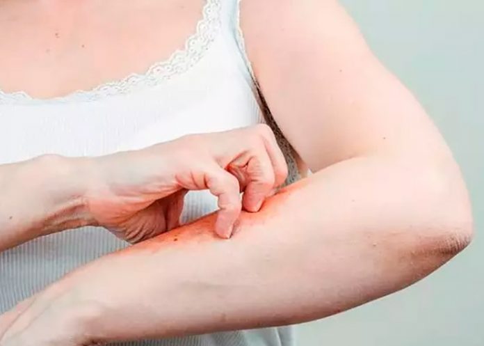 Descubren bacterias, hongos y virus desconocidos en la piel humana